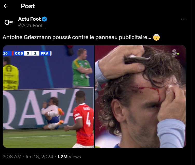 x - Antoine Griezmann mendorong papan iklan... 🤕